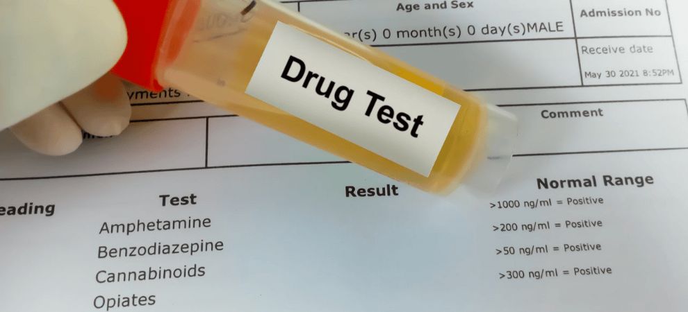 Yes, Delta 8 THC can show up on a drug test. That's because your body processed D8 the same way as its more powerful cannabinoid counterpart, D9 THC.