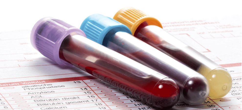 Well, the answer is only 3 to 4 hours after last use. This is the reason blood tests aren’t commonly used to test for THC, CBD, and other cannabinoids.